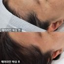 강서구 명지 헤어라인 왁싱추천 매료한왁싱&amp; 스킨