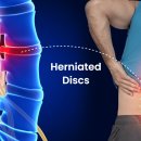 메디포스 이미지