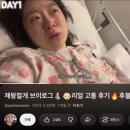 희망가스 | 응급 제왕절개 출산 후기 2일차 : 제왕통증 페인버스터 매직 희망편, 절망편 (일어나기, 용변보기)