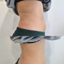 TNT | 부산 서면 슬리밍관리 추천:애리서면왁싱 에스테틱 TNT 복부관리 솔직후기