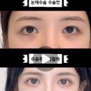 준성형외과 이미지