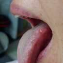 보보한의원 이미지