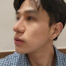 강남역 피부과 피코슈어토닝 잡티와 피부톤 관리 받고 달라진 변화 후기
