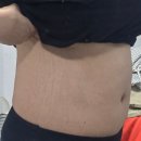 하루비결연구소 | 묵은 노폐물 비워내는 디톡스 비결! 중앙미생물연구소 캐치콜 라이트 리얼 후기