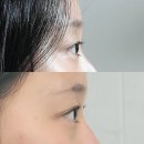 아이뷰속눈썹네일 | [대구 수성구] 연장한 것 같은 속눈썹펌 , 이끌림아이뷰티