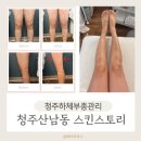 두꺼비로60번길(3-248) | 하체 부종·셀룰라이트 이 관리하나로 끝! 청주산남동스킨스토리 리얼 후기!