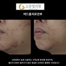 순천의원 티스토리