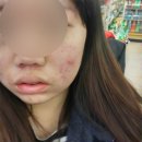 [일원2] 내 화장품의 진실 | 여드름 피부 클렌징 오일 추천,모에즈(moez)/내돈내산 화장품 추천