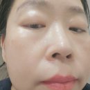 킴방울뷰티 | 레디 보이 슈퍼 앰플 연꽃PDRN 고영양 앰플 선물추천 후기