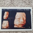 문래동 아란태 산부인과 사거리 1 | [서울 영등포 문래동 아란태산부인과 제왕절개 후기] 38주 5일 선택제왕 출산 후기 (최윤경원장님...