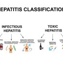 간염 이미지