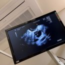 에프엠2차 이미지