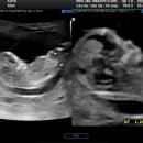 신제일산부인과의원 이미지
