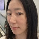 수아벨라 | 광주피부관리 윤곽 웨딩 색소관리 후기 수아벨라