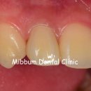 동그라미 치과기공소 이미지