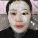 더웰피부과의원 | 관저동 더웰피부과 잡티제거