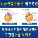 고관절인공관절 - 인공관절수술잘하는곳에서 해야하는이유 !! 이미지