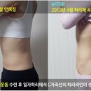 SNPE척추운동 이미지