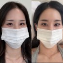 얼짱미인 | [공지] 대전눈썹문신 추천 "아스닝브로우" 후기 / 위치 / 가격