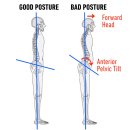 팔머메디스포츠 이미지