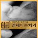 연세바른치과 이미지