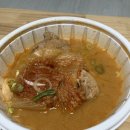 무거본뼈 이미지