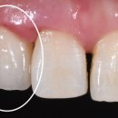 엘리트치과기공소 이미지