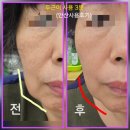 주식회사 이엠티헬스케어 | “치매 예방부터 피부 케어까지! 두근이 하나면 OK”