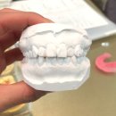 연세리더스치과교정과치과의원 | 김포교정치과 추천 구래동 연세진석치과, 내돈내산 교정 후기와 유지관리까지