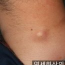 연세화산외과 이미지