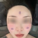 창원중동피부관리,창원 유니시티 에스테틱 추천 : 뉴욕부티크 에스테틱 원모드 리프팅관리 후기