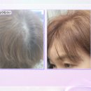 미라클푸드 이미지