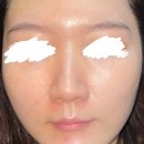 오월의아침피부과의원 | 비비크림 추천 파데프리비비 오월의아침 피부과 오월의아침 후기 비단 비비크림