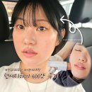 왕십리 피부과 리프팅 관리 추천 덴서티하이 600샷 통증 효과 후기