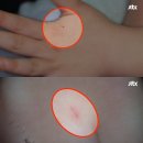 손과바늘 이미지