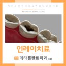 메타플란트치과의원 이미지