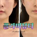 세븐일레븐 서대구센트럴자이점 | 대구 서구 피부관리 플라미뷰티 최신상 관리기기 알테온 후기 리프팅 관리 추천