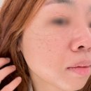 경기광주피부관리 태전동에서 데미지리페어로 수분고속충전부터 진정회복으로 최고의 관리