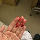 쟈니하우스 | 서울 한남동 순천향대학병원 쌍둥이 고위험산모 입원후기 3편, 드디어 제왕절개 수술일자 확정