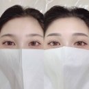 그린브로우