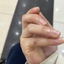 이노플러스성형외과의원 | [전주 화상전문병원 추천] 이노플러스 성형외과의원