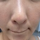 유유스킨케어 | 마데카프라임맥스 변화된 스킨케어순서 2주차 사용후기