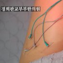 경희나은한의원 | 노로바이러스 장염 이후 설사가 멎지 않아요 / 성남 한의원 소화기내과