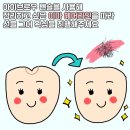 선헤어라인 이미지