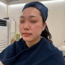 이쁜 피부 부탁해 | 구로 신도림 이쁜피부부탁해 스페셜 피부관리 후기