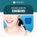새로이치과교정과치과의원 | 제주 연동 치과 의원 인비절라인(Invisalign) 교정치료에 대해