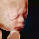 웰하이여성아동병원 | [웰하이여성아동병원] AI 입체초음파 후기