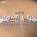 성수 피부관리 코벨스킨 약초필링 등관리 후기