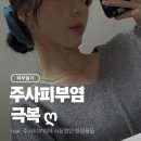 피에이치5.5(pH5.5) | 주사피부염(rosacea) 치료 완치 | 찐 사용 화장품 공유