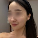 평촌1 | 평촌 에스테틱 추천 위뷰티 평촌점 작은얼굴 1회 변화 후기